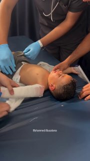 👤 Mohammed Abusalama 📝 One-and-a-half-year-old child Ghaith Younis Abu Drabi was injured after being shot by Israeli for